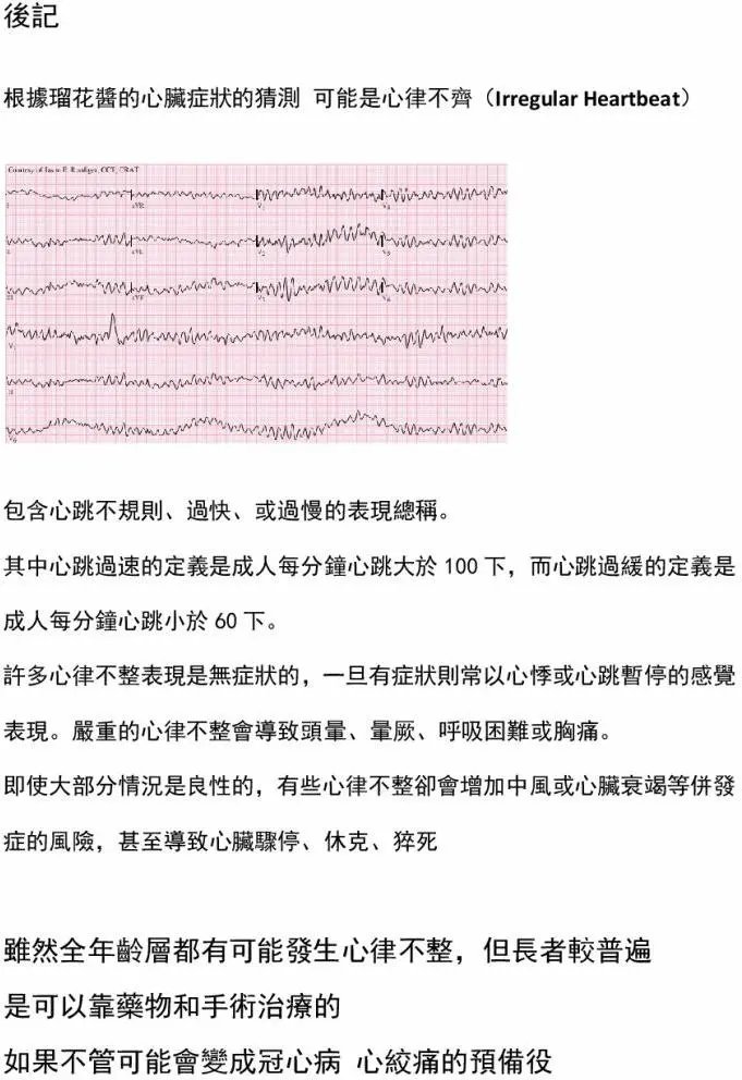 第28回