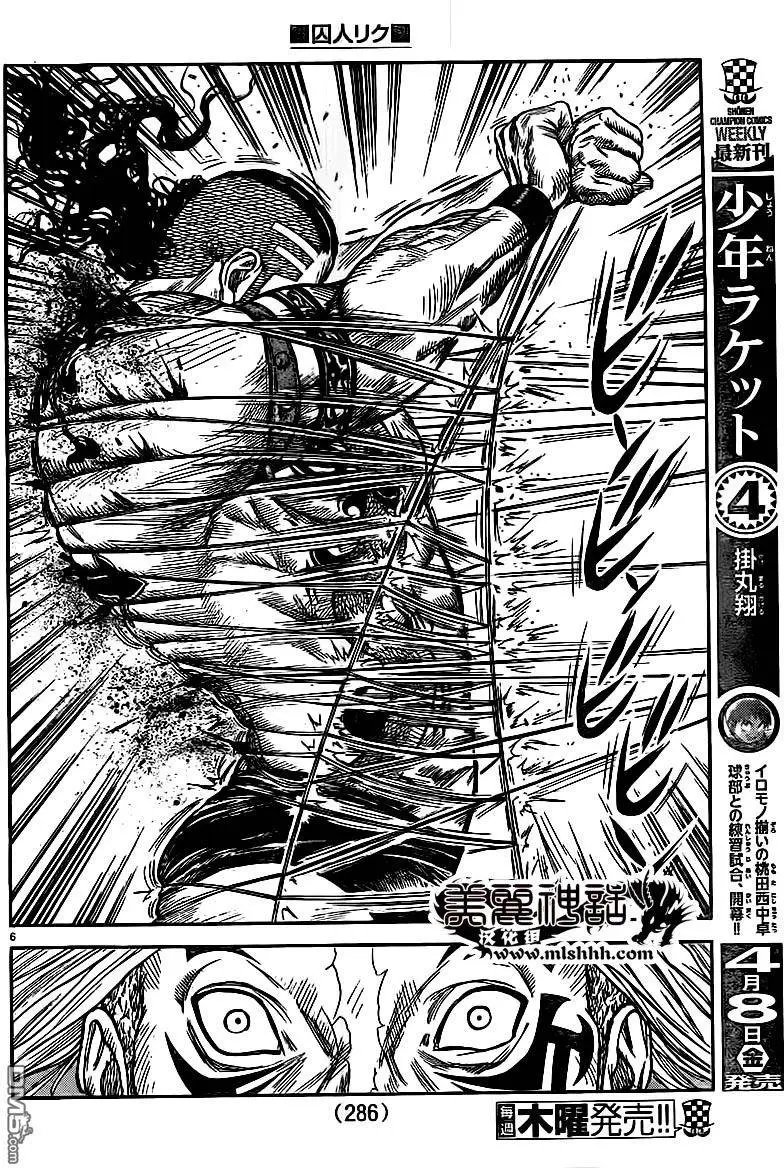 第247回 痛觉