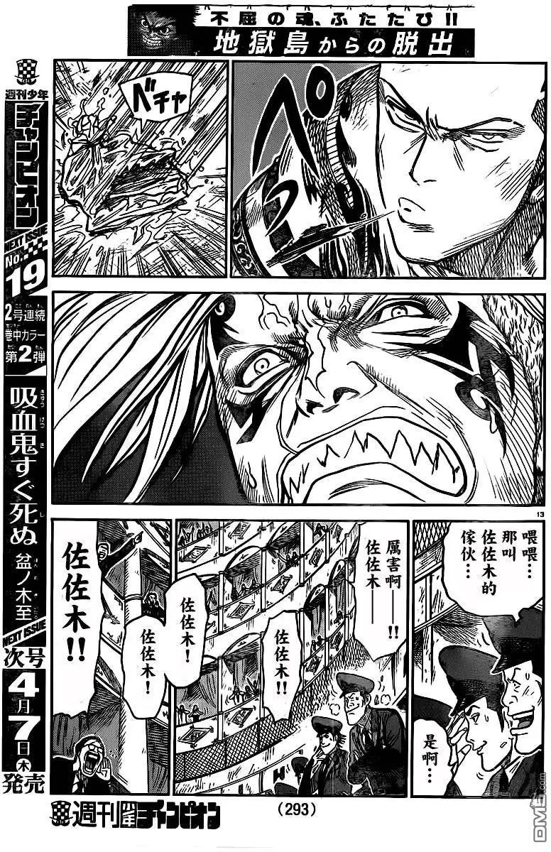 第247回 痛觉