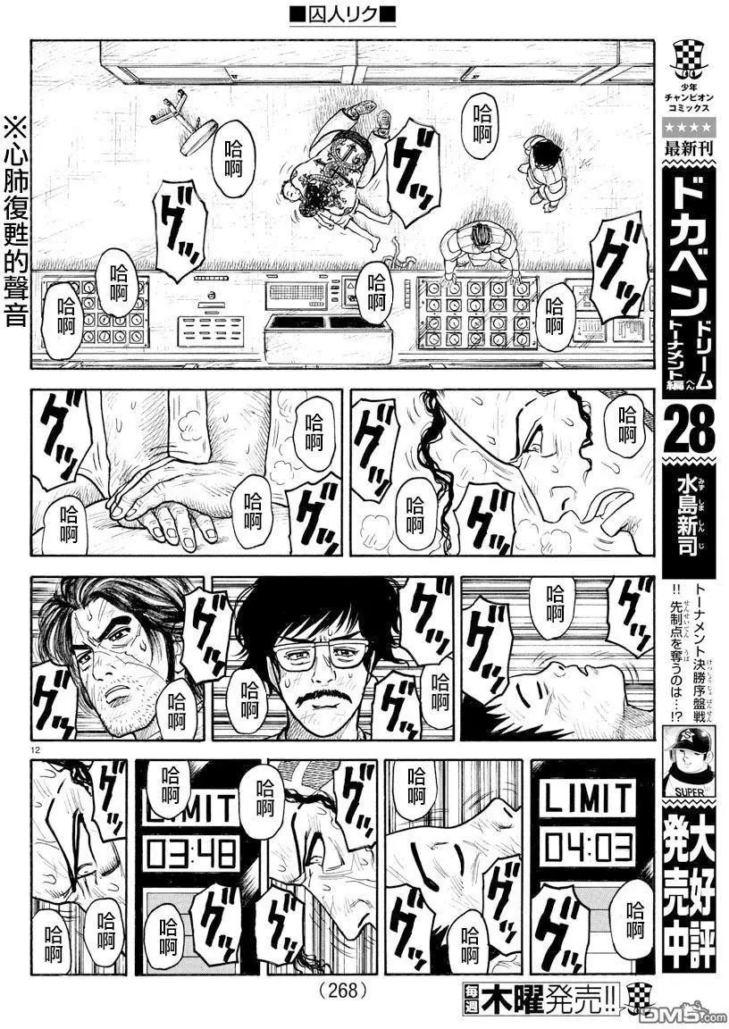 第315回 苏生
