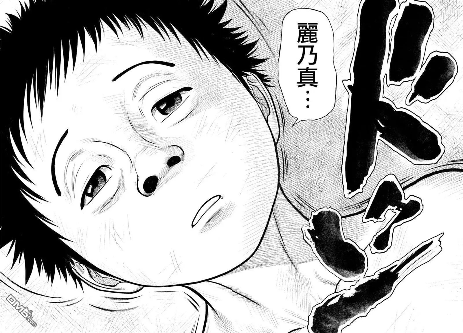 第315回 苏生